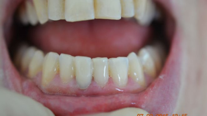 Just one tooth malta, dentist malta, dentistry malta, dental clinic malta, regional dental clinic malta