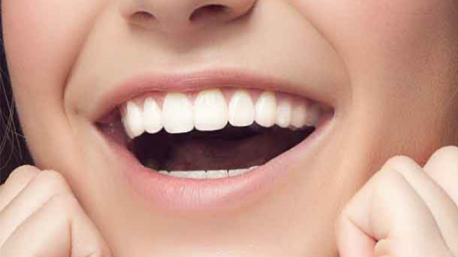Gum Contouring & Teeth Reshaping malta, Gum Contouring &  Teeth Reshaping malta, dentist malta, dentistry malta, dental clinic malta, regional dental clinic malta